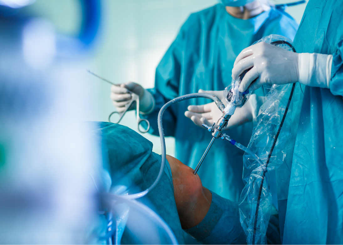 General and Laparoscopy Surgery